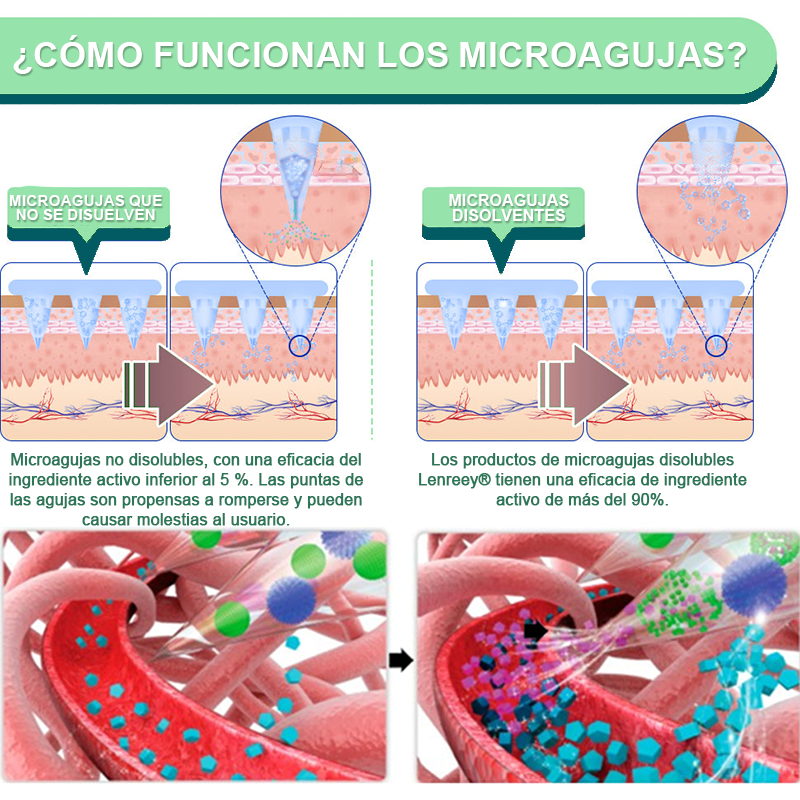 【🎯 ¡Último día de promoción! 60% DE DESCUENTO 🏅】 Lenreey® NIDDK-Tirzepatide Slimming & Health NANO MICRONEEDLE PATCH (Sin dolor · Liberación 24/7 · Pierde 9 kg RÁPIDO · Hasta 90 % menos azúcar en sangre 🌞
