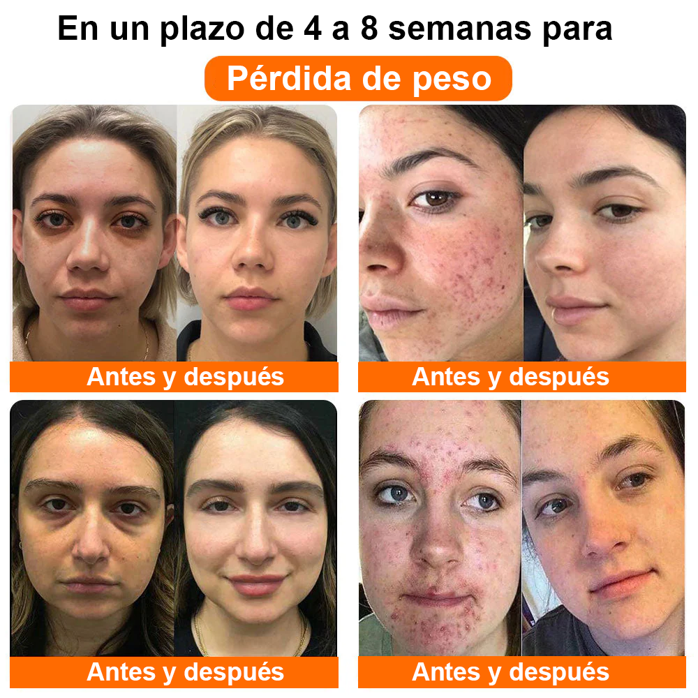 𝐂𝐯𝐫𝐞𝐨𝐳® Cápsulas Vaginales Naturales Reparadoras con Veneno de Abeja y NMN👩‍❤️‍👩[𝐅𝐨𝐫 𝐚𝐥𝐥 𝐯𝐚𝐠𝐢𝐧𝐚𝐥 𝐚𝐧𝐝 𝐡𝐨𝐫𝐦𝐨𝐧𝐚𝐥 𝐩𝐫𝐨𝐛𝐥𝐞𝐦𝐬]👩‍❤️‍👩