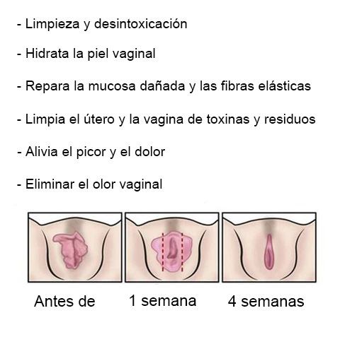 𝐂𝐯𝐫𝐞𝐨𝐳® Cápsulas Vaginales Naturales Reparadoras con Veneno de Abeja y NMN👩‍❤️‍👩[𝐅𝐨𝐫 𝐚𝐥𝐥 𝐯𝐚𝐠𝐢𝐧𝐚𝐥 𝐚𝐧𝐝 𝐡𝐨𝐫𝐦𝐨𝐧𝐚𝐥 𝐩𝐫𝐨𝐛𝐥𝐞𝐦𝐬]👩‍❤️‍👩